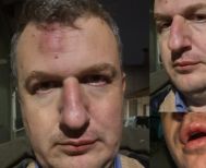 Ξυλοδαρμός του εκδότη της ΜΑΓΝΗΣΙΑΣ- Γρονθοκόπησαν τον Αρχιμήδη Καρεκλίδη έξω από το σπίτι του «Οι τραμπουκισμοί και ο εκφοβισμός δεν μας πτοούν», το μήνυμα του εκδότη ΑΝΑΚΟΙΝΩΣΗ ΤΟΥ ΣΥΝΔΕΣΜΟΥ ΗΜΕΡΗΣΙΩΝ ΠΕΡΙΦΕΡΕΙΑΚΩΝ ΕΦΗΜΕΡΙΔΩΝ