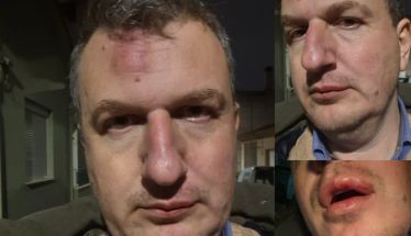 Ξυλοδαρμός του εκδότη της ΜΑΓΝΗΣΙΑΣ- Γρονθοκόπησαν τον Αρχιμήδη Καρεκλίδη έξω από το σπίτι του «Οι τραμπουκισμοί και ο εκφοβισμός δεν μας πτοούν», το μήνυμα του εκδότη ΑΝΑΚΟΙΝΩΣΗ ΤΟΥ ΣΥΝΔΕΣΜΟΥ ΗΜΕΡΗΣΙΩΝ ΠΕΡΙΦΕΡΕΙΑΚΩΝ ΕΦΗΜΕΡΙΔΩΝ