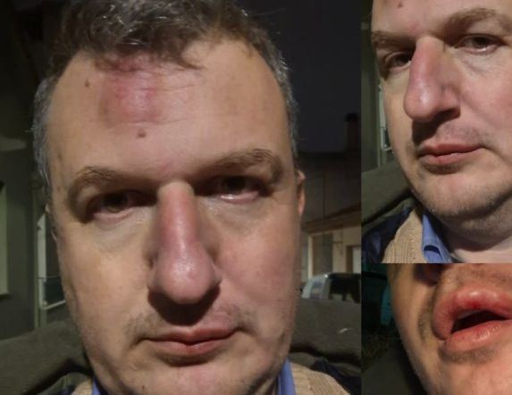 Ξυλοδαρμός του εκδότη της ΜΑΓΝΗΣΙΑΣ- Γρονθοκόπησαν τον Αρχιμήδη Καρεκλίδη έξω από το σπίτι του «Οι τραμπουκισμοί και ο εκφοβισμός δεν μας πτοούν», το μήνυμα του εκδότη ΑΝΑΚΟΙΝΩΣΗ ΤΟΥ ΣΥΝΔΕΣΜΟΥ ΗΜΕΡΗΣΙΩΝ ΠΕΡΙΦΕΡΕΙΑΚΩΝ ΕΦΗΜΕΡΙΔΩΝ